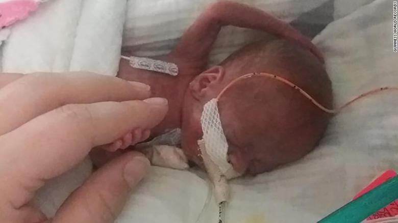 Kansas earns C in March of Dimes report card on premature births