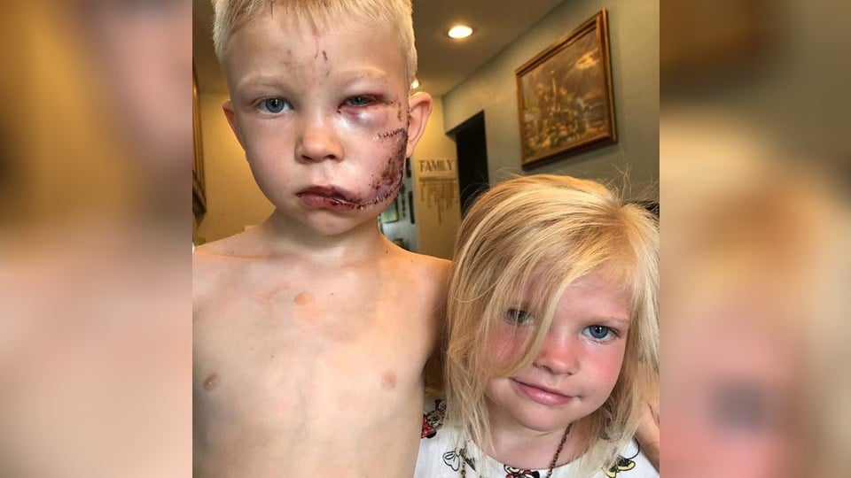 6-year-old boy risks his life to save sister from brutal dog att 